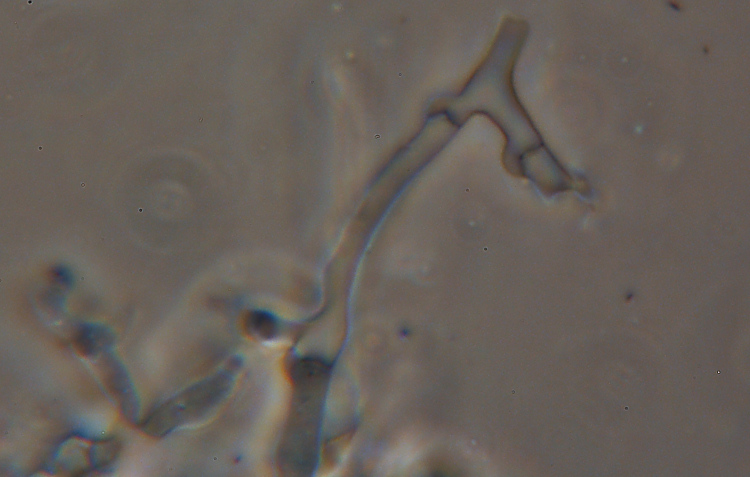 Labile crosticina bianca - foto 3259 (Trechispora farinacea)